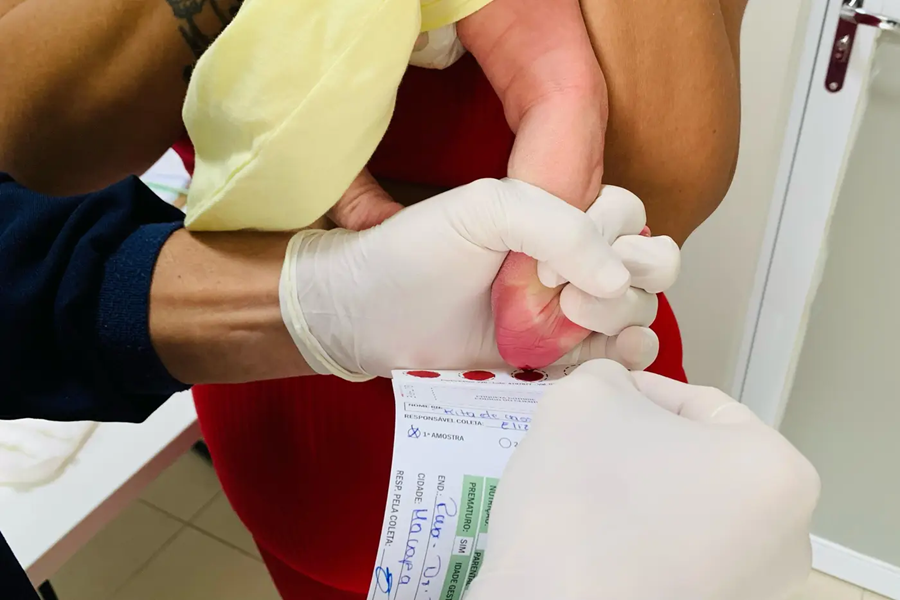Hospital da Mulher Mãe Luzia realiza cerca de 350 testes do pezinho por mês em Macapá; saiba como é realizado