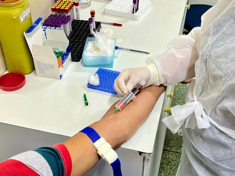 Governo do Amapá amplia oferta de exames laboratoriais para pacientes que convivem com doenças virais, em Macapá