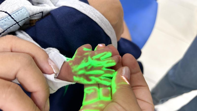 Governo do Amapá adquire 'caça veias', modernos aparelhos que possibilitam maior precisão em procedimentos venosos nos recém-nascidos