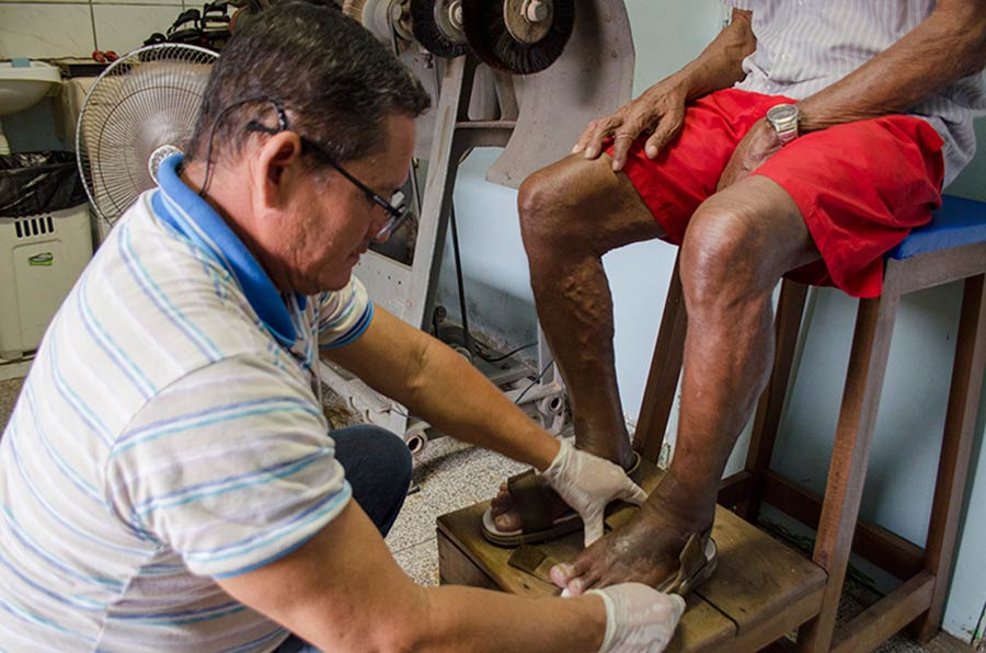 Palmilhas adaptadas fornecidas pelo CRDT ajudam no tratamento de pacientes com hanseníase
