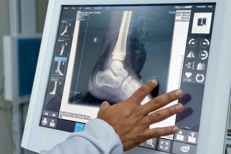 Com novos equipamentos, Hospital de Emergências realiza 8.641 exames de imagens durante o mês de outubro, em Macapá