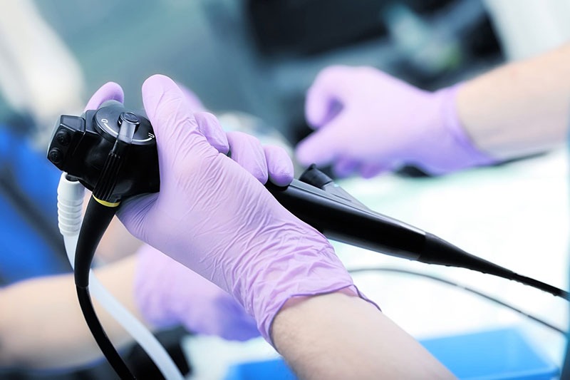 Governo do Estado passa a ofertar exame de broncoscopia para diagnóstico de tuberculose