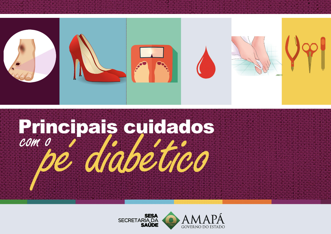 Especialista explica cuidados para evitar pé diabético