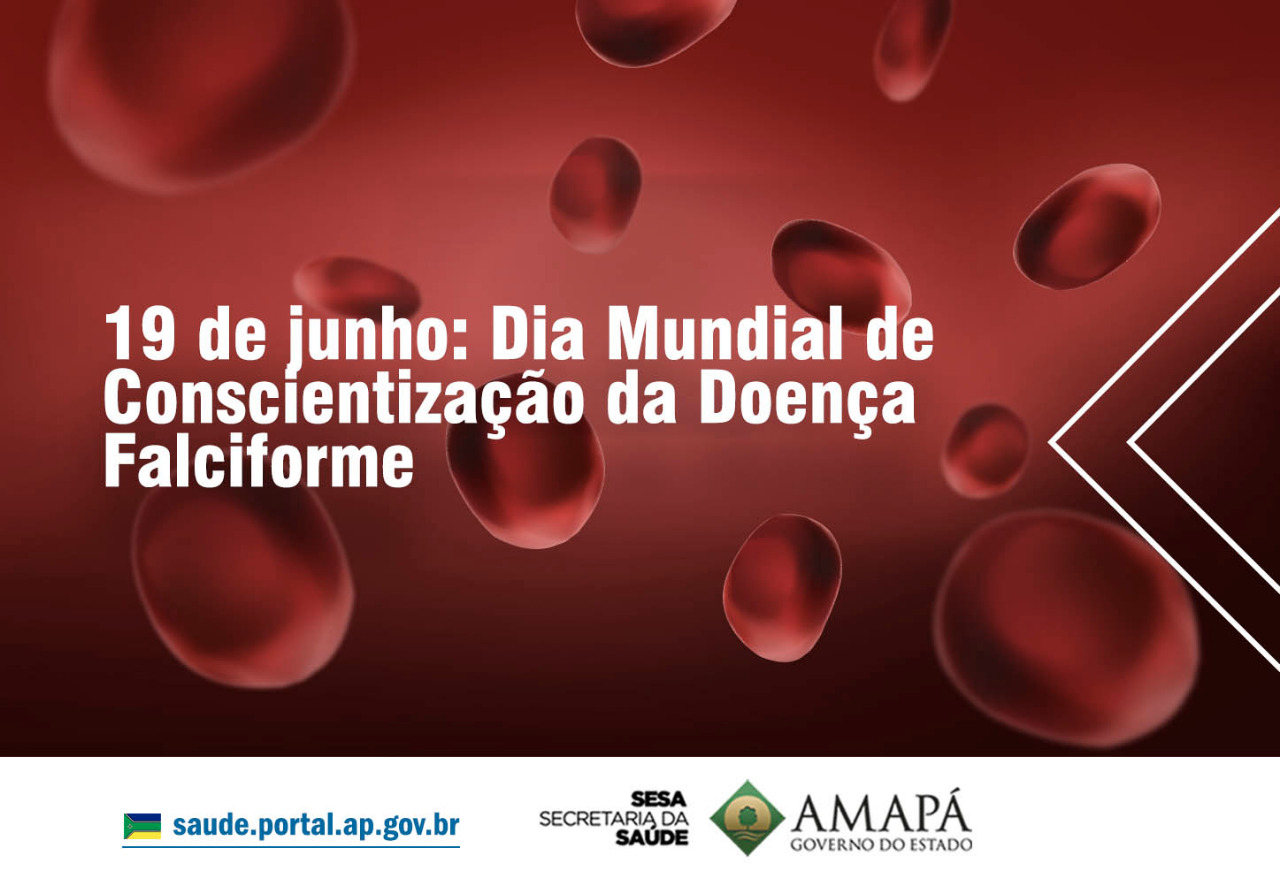 Hemoap é referência em atendimento a pessoas com anemia falciforme