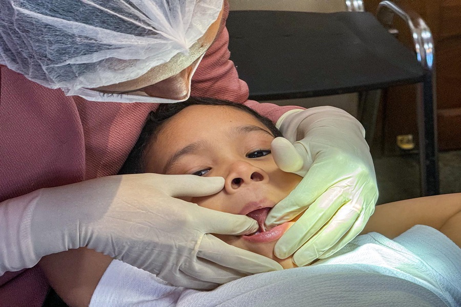 Governo do Amapá oferece cirurgia de freio lingual para melhorar qualidade de vida dos pacientes