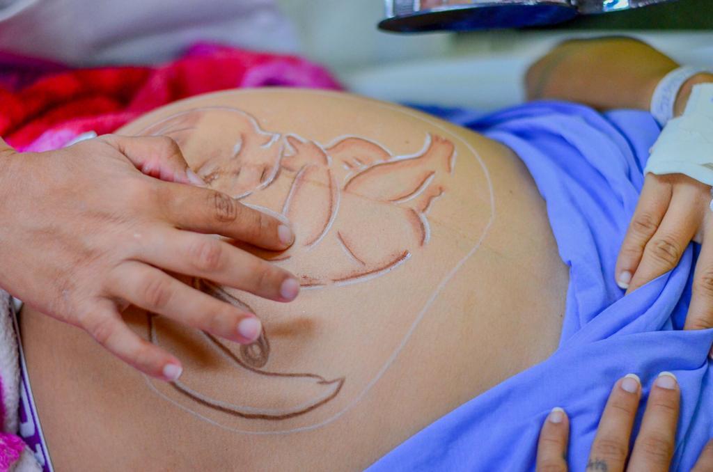 Mais de 18% dos bebês nascidos no Amapá foram gerados por mães adolescentes, em 2022
