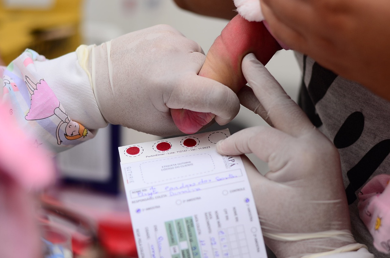 Governo do Amapá disponibiliza teste do pezinho no Hospital de Santana