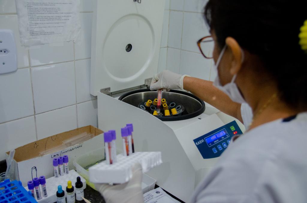 No Amapá, laboratório do HE realiza em média mil exames diários