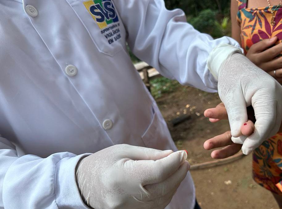 Governo do Amapá capacita profissionais de saúde para aperfeiçoar diagnóstico e tratamento de infecções sexualmente transmissíveis