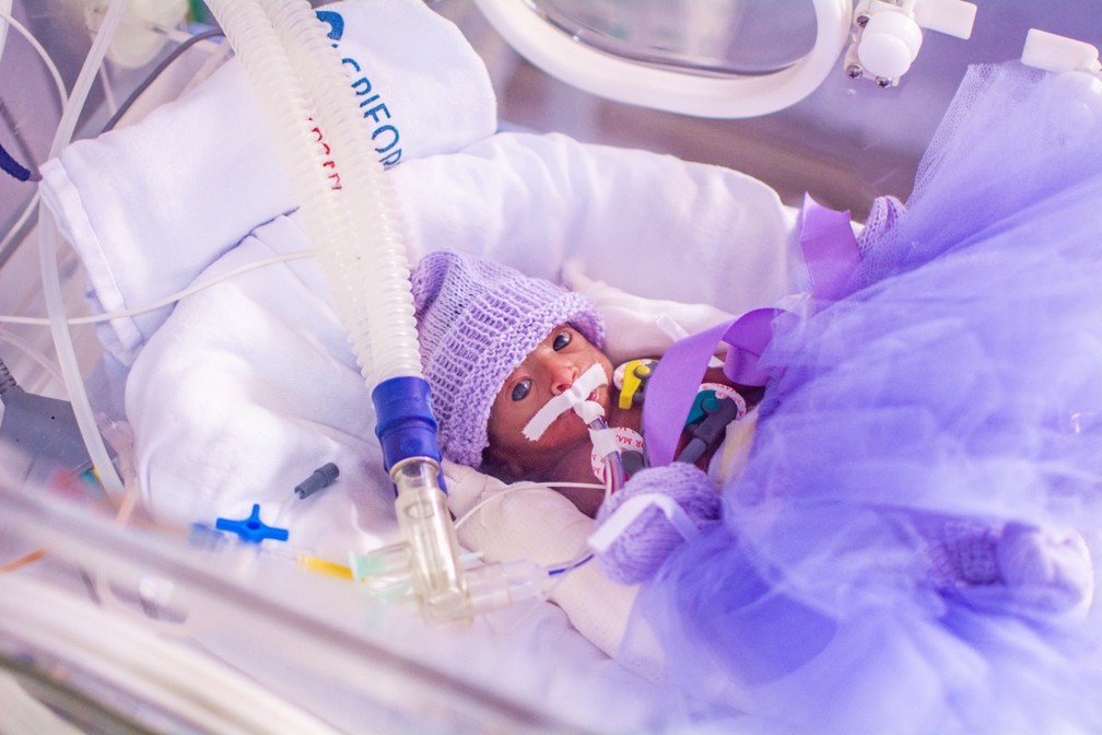 Campanha Novembro Roxo: Hospital da Mulher alerta sobre riscos do nascimento prematuro