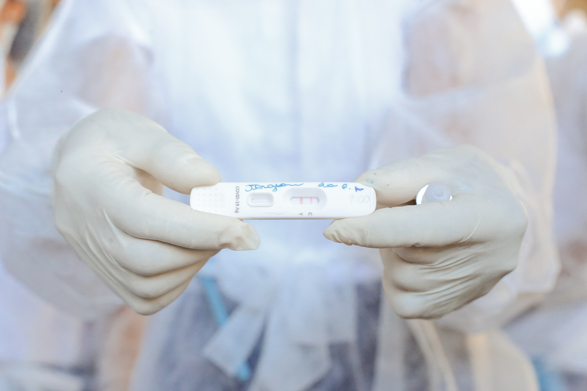 Covid-19: Amapá registra aumento de casos, mas internações e óbitos permanecem controlados