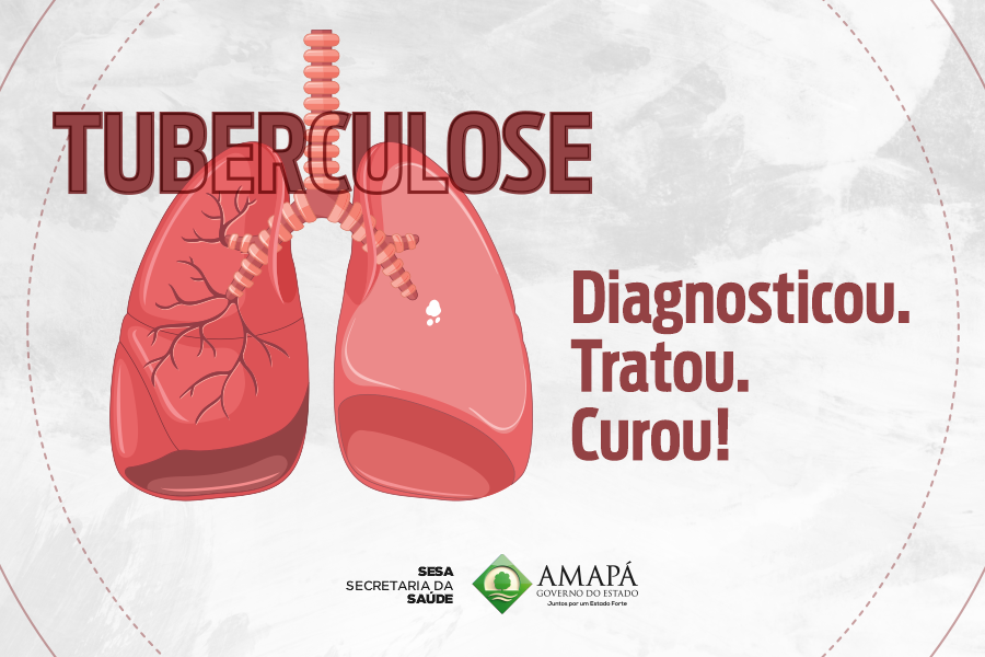 Estado alerta para aumento de 41% nos casos de tuberculose