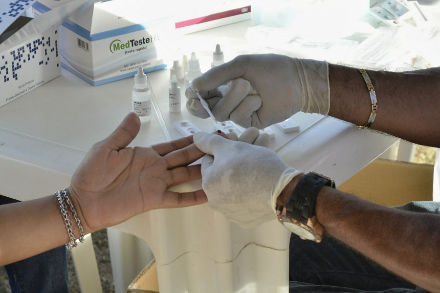 Sesa registra 90 novos casos de HIV no primeiro trimestre de 2021