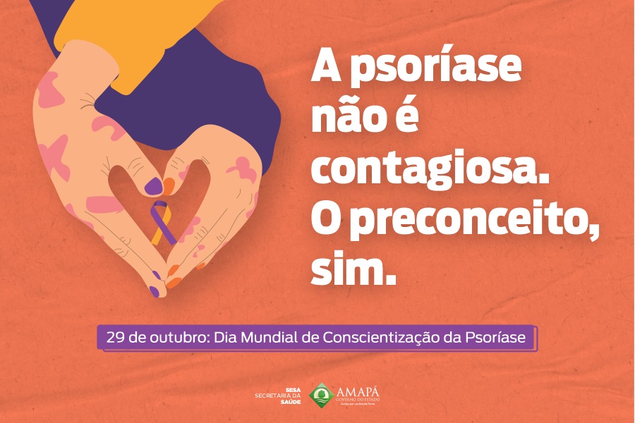 Dia de Conscientização da Psoríase chama atenção para fim do preconceito